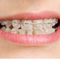 Minum Pil KB, Tiga Gigi Palsu Warga Nganjuk Tertelan