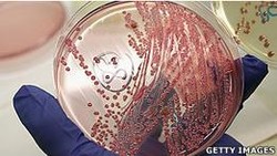 Kemenkes Perintahkan Pelabuhan Cermati Penumpang dari Eropa yang Diare