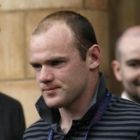 Rooney Senang dengan Transplantasi Rambutnya
