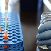 Menkes: E. coli Indonesia Beda Dengan yang Berbahaya di Eropa