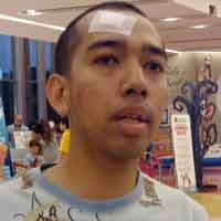 Kaca Pagar Grand City Pecah, Kening Pelatih Ice Skating Mendapat Dua Jahitan