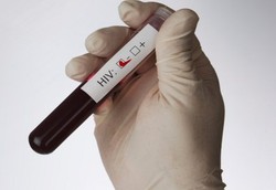 Tes untuk Tahu Apakah Anda Terkena Infeksi Menular Seksual