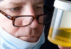 Tes Urine untuk Deteksi Awal Kanker