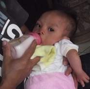 Bayi Dede Tegar Diboyong ke Jakarta untuk Operasi Bibir Sumbing