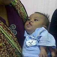 Dokter akan Lakukan Tiga Operasi untuk Bayi Dede Tegar