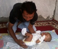 Menkes: Penanganan Bayi Tanpa Mulut & Hidung Butuh Waktu Lama