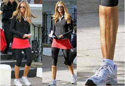 Kaki Mulus Supermodel Jadi Aneh Karena Efek Negatif Tanning