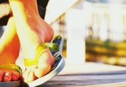 Sandal Jepit dan Topi Baseball Tingkatkan Risiko Kanker Kulit