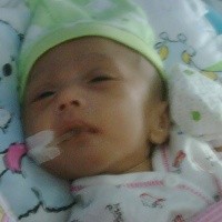 Usus Masih Terburai, Bintang Sudah Punya Anus Buatan