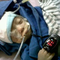 Bayi Bintang Usus Terburai Tutup Usia