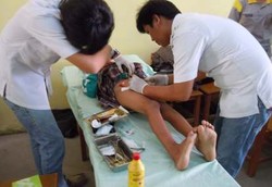 Musim Sunat Telah Tiba, Tinggal Pilih Teknik Sunatnya