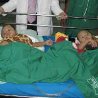 Kembar Siam Rochman Rochim akan Dipulangkan ke Jombang