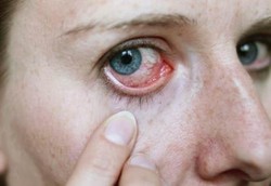 Orang Indonesia Tak Mau Donor Mata Karena Tabu 