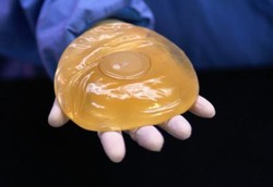 Implan Payudara Tak Boleh Dipasang Seumur Hidup