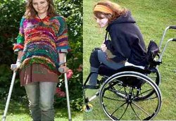 Gadis yang Selalu Pingsan Saat Berdiri, Kini Bisa Berdiri Tegak