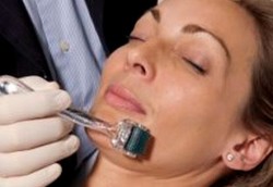 Plasenta Domba Bisa Hilangkan Keriput Selama 5 Bulan 