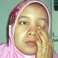 TKW Asal Sidoarjo Alami Penyiksaan di Hong Kong