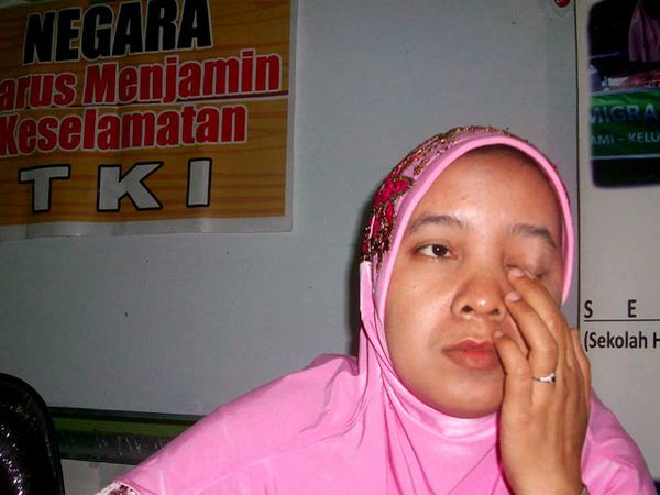 TKW Asal Sidoarjo Alami Penyiksaan