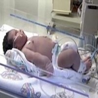 Wow! Bayi Laki-laki Lahir Dengan Berat 7,3 Kg