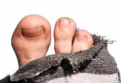 Bau Kaki Dijadikan Perangkap Nyamuk Baru