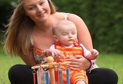 Mata Bocah Tak Bisa Melek Sejak Dilahirkan