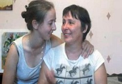 Bakat Seni Muncul Setelah Hidup dengan Otak Separuh