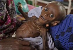 Bocah-bocah Sekarat Karena Kelaparan Parah