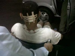 Bassist Navicula Terluka di Kepala Karena Terjun dari Panggung