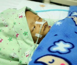 Abdul Dapi, Balita 2,9 Tahun Penderita Gizi Buruk dari Jakarta