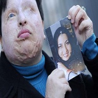 TV Iran Siarkan Adegan Dramatis Wanita Ampuni Pelaku Serangan Asam