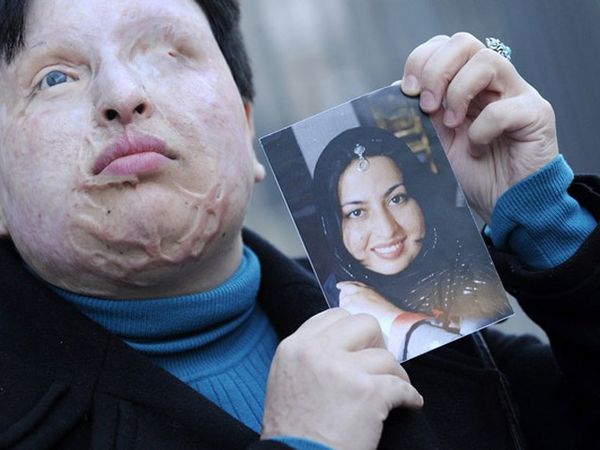 Bahrami Ampuni Orang Yang Membutakanya