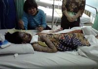Kulit Ratna Melepuh Usai Berobat ke Puskesmas  