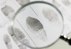 Kenapa Ada Orang yang Tidak Punya Sidik Jari?