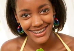 Yang Harus Dihindari Saat Pakai Kawat Gigi