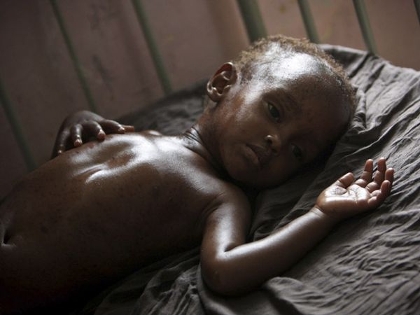 Rakyat Somalia Menanti Derma