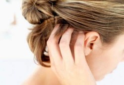 Penderita Psoriasis Bisa Meriang Jika Dilarang Garuk-garuk