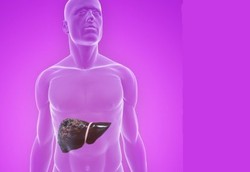 Kekurangan Vitamin D Rawan Kena Gangguan Hati