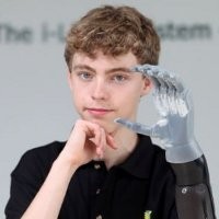 Mercedes Hadiahi ABG Tangan Bionik