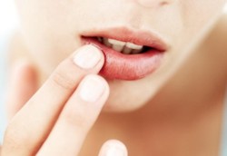 Bibir Bisa Jadi Indikator Kesehatan