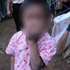 RH, Bocah 10 Tahun Habiskan Sebungkus Rokok Sehari