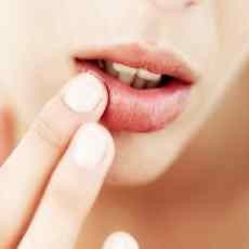 Bibir Kering Saat Puasa Cegah Dengan Konsumsi Vitamin C