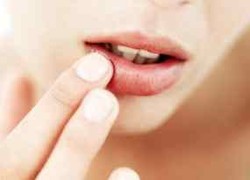 Bibir Kering Saat Puasa Cegah Dengan Konsumsi Vitamin C