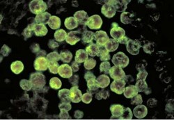 Amuba Pemakan Otak Tewaskan Tiga Orang