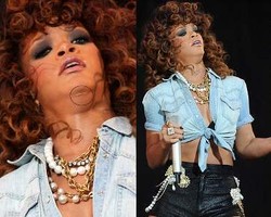 Rihanna Terlihat Punya Luka Misterius di Dagu