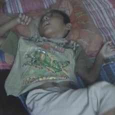 Tiga Bocah Malang di Kediri Lumpuh Sejak Kecil