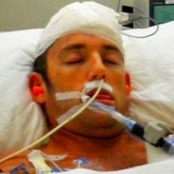 Alami Kerusakan Otak, Stuntman Hangover II Tuntut WB