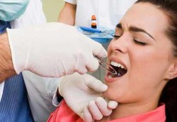 Kapan Gigi Geraham Bungsu Perlu Dicabut?