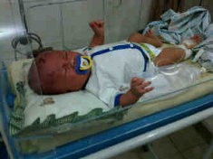 Bayi Korban Gempa tak Dapat Pelayanan Maksimal di RSUP Adam Malik