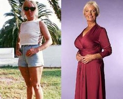 Operasi Payudara, Nenek 13 Cucu Dipacari Berondong