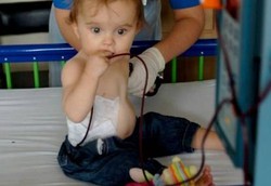 Bayi yang Sudah Harus Transfusi Darah Sejak Dalam Kandungan